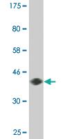 Anti-DYRK2 Mouse Monoclonal Antibody [clone: 2F9]