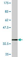 Anti-KLHL2 Mouse Monoclonal Antibody [clone: 3G3]