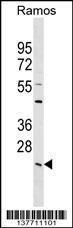 Anti-LYPLA2 Rabbit Polyclonal Antibody (AP (Alkaline Phosphatase))