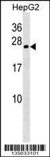 Anti-CRYGB Rabbit Polyclonal Antibody (Biotin)