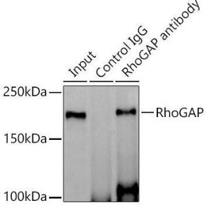 Anti-RhoGAP Rabbit Monoclonal Antibody [clone: ARC1916]