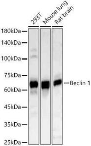 Western blot analysis of various lysates, using Anti-Beclin 1 Antibody (A307235) at 1:1,000 dilution The secondary antibody was Goat Anti-Rabbit IgG H&L Antibody (HRP) at 1:10,000 dilution Lysates/proteins were present at 25 µg per lane