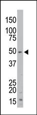 Anti-STK35 Rabbit Polyclonal Antibody