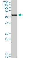 Anti-FOXC2 Mouse Monoclonal Antibody [clone: 3H5]