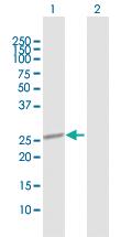 Anti-OTUB2 Rabbit Polyclonal Antibody