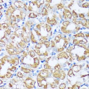 Immunohistochemistry analysis of paraffin-embedded human stomach using Anti-Beclin 1 Antibody (A307235) at a dilution of 1:100 (40x lens) Perform microwave antigen retrieval with 10 mM PBS buffer pH 72 before commencing with IHC staining protocol