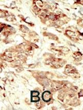 Anti-STK35 Rabbit Polyclonal Antibody