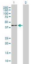 Anti-BHMT2 Rabbit Polyclonal Antibody