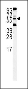 Anti-HTRA1 Rabbit Polyclonal Antibody (AP (Alkaline Phosphatase))