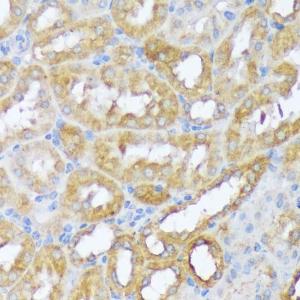 Immunohistochemistry analysis of paraffin-embedded mouse kidney using Anti-Beclin 1 Antibody (A307235) at a dilution of 1:100 (40x lens) Perform microwave antigen retrieval with 10 mM PBS buffer pH 72 before commencing with IHC staining protocol