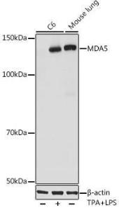 Western blot analysis of extracts of various cell lines, using Anti-MDA5 Antibody [ARC0760] (A308247) at 1:1000 dilution