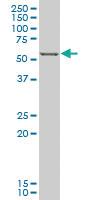 Anti-FOXC2 Mouse Monoclonal Antibody [clone: 3H5]