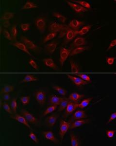 Immunofluorescence analysis of NIH/3T3 cells using Anti-Beclin 1 Antibody (A307235) at a dilution of 1:200 (40x lens) DAPI was used to stain the cell nuclei (blue)