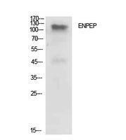 Anti-ENPEP antibody