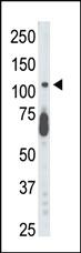 Anti-CDKL5 Rabbit Polyclonal Antibody