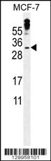 Anti-MBD3L3 Rabbit Polyclonal Antibody