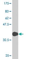 Anti-TWIST1 Mouse Monoclonal Antibody [clone: 1B8]