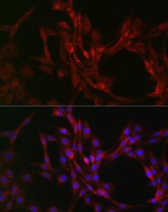 Immunofluorescence analysis of PC-12 cells using Anti-Beclin 1 Antibody (A307235) at a dilution of 1:200 (40x lens) DAPI was used to stain the cell nuclei (blue)