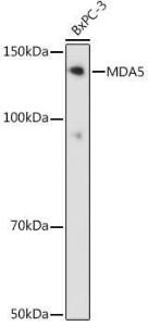 Western blot analysis of extracts of BxPC-3 cells, using Anti-MDA5 Antibody [ARC0760] (A308247) at 1:1000 dilution