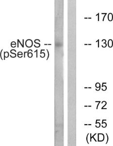 Western blot analysis of lysates from K562 cells treated with EGF 40nM 30' using Anti-eNOS (phospho Ser615) Antibody. The right hand lane represents a negative control, where the antibody is blocked by the immunising peptide