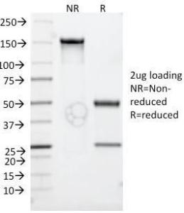 SDS-PAGE analysis of Anti-CD30 Antibody [Ki-1/779] under non-reduced and reduced conditions; showing intact IgG and intact heavy and light chains, respectively. SDS-PAGE analysis confirms the integrity and purity of the Antibody