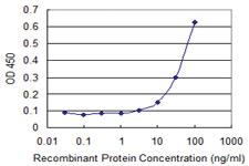 Anti-FOXC2 Mouse Monoclonal Antibody [clone: 3H5]