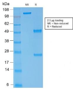 SDS-PAGE analysis of Anti-alpha 1 Spectrin Antibody [rSPTA1/1832] under non-reduced and reduced conditions; showing intact IgG and intact heavy and light chains, respectively. SDS-PAGE analysis confirms the integrity and purity of the Antibody