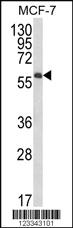 Anti-IL10RA Rabbit Polyclonal Antibody