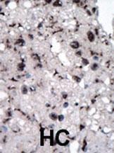 Anti-HK2 Rabbit Polyclonal Antibody