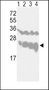 Anti-UCHL1 Rabbit Polyclonal Antibody (FITC (Fluorescein))