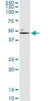 Anti-ELN Polyclonal Antibody Pair