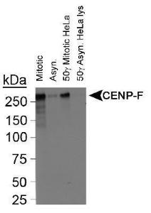 Anti-LCAT Rabbit Polyclonal Antibody