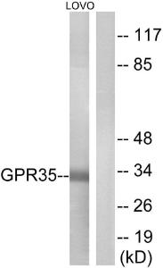 Western blot analysis of lysates from LOVO cells using Anti-GPR35 Antibody. The right hand lane represents a negative control, where the antibody is blocked by the immunising peptide.