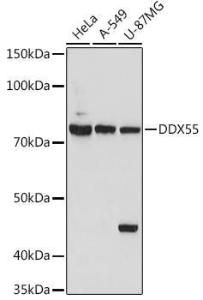 Western blot analysis of extracts of various cell lines, using Anti-DDX55 Antibody (A307238) at 1:1,000 dilution. The secondary antibody was Goat Anti-Rabbit IgG H&L Antibody (HRP) at 1:10,000 dilution.