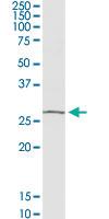 Anti-OTUB2 Rabbit Polyclonal Antibody