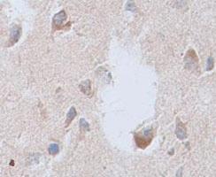 Anti-CNTFR Rabbit Polyclonal Antibody