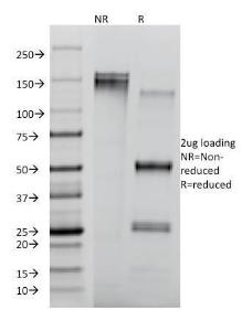 SDS-PAGE analysis of Anti-CD8A Antibody [RIV11] under non-reduced and reduced conditions; showing intact IgG and intact heavy and light chains, respectively. SDS-PAGE analysis confirms the integrity and purity of the antibody