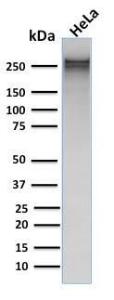 Western blot analysis of human HeLa cell lysate using Anti-alpha 1 Spectrin Antibody [rSPTA1/1832]