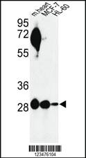 Anti-CCND2 Rabbit Polyclonal Antibody