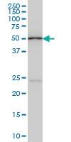 Anti-POLE2 Mouse Monoclonal Antibody [clone: 1A3]