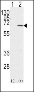 Anti-PIAS1 Rabbit Polyclonal Antibody (Biotin)