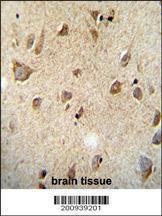 Anti-RET Mouse Monoclonal Antibody [clone: 188CT11.2.3]