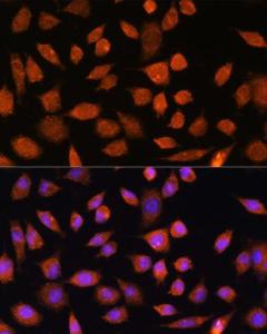 Immunofluorescence analysis of L929 cells using Anti-PLD3 Antibody (A307239) at a dilution of 1:100. DAPI was used to stain the cell nuclei (blue)