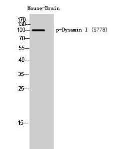 Western blot analysis of mouse brain cells using Anti-DYN1 (phospho Ser778) Antibody