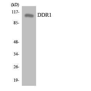 Western blot analysis of the lysates from HepG2 cells using Anti-DDR1 Antibody