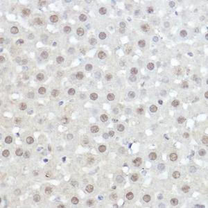 Immunohistochemistry analysis of paraffin-embedded mouse liver using Anti-AHNAK Antibody (A307240) at a dilution of 1:50 (40X lens). 1. Perform high pressure antigen retrieval with 10 mM citrate buffer pH 6.0 before commencing with IHC staining protocol