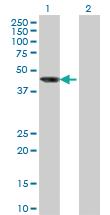 Anti-AIPL1 Mouse Monoclonal Antibody [clone: 1E1]