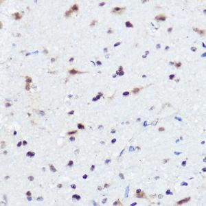 Immunohistochemistry analysis of paraffin-embedded mouse brain using Anti-AHNAK Antibody (A307240) at a dilution of 1:50 (40X lens). 1. Perform high pressure antigen retrieval with 10 mM citrate buffer pH 6.0 before commencing with IHC staining protocol