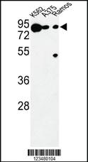 Anti-DCT Rabbit Polyclonal Antibody