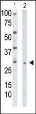 Anti-TK2 Rabbit Polyclonal Antibody (AP (Alkaline Phosphatase))